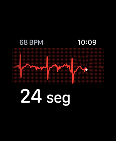 App ECG com batimentos por minuto no canto superior esquerdo, linha de ritmo e timer