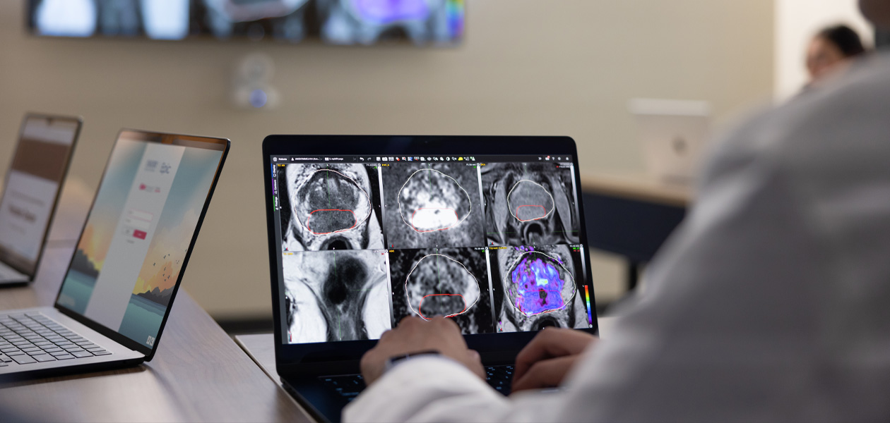 Iemand bekijkt scans op een MacBook. Op de achtergrond staan nog twee MacBooks met een opengeklapt scherm.
